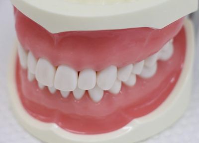 タカダ歯科 虫歯