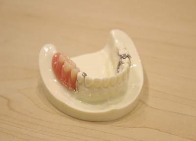 患者さまがお持ちの入れ歯を当院で修正して患者さまのご要望に合った入れ歯に変えていく