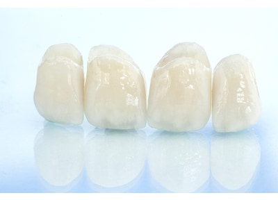 山の手デンタルオフィス田町三田 つめ物・かぶせ物