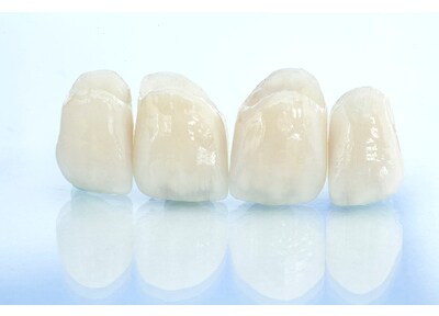 みやはら歯科医院 つめ物・かぶせ物