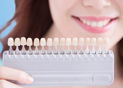 ホームホワイトニング（全顎）