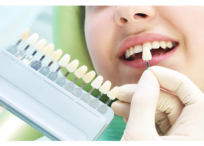 医療法人社団 ＥＶＩＤＥＮＳ　ぶばい歯科クリニック ホワイトニング