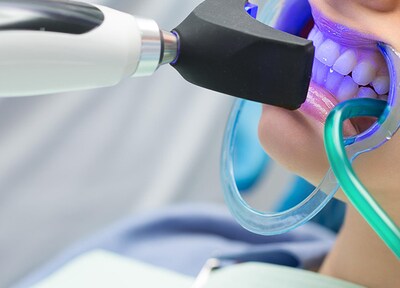 オフィスホワイトニング