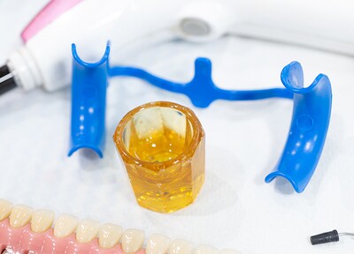 オフィスホワイトニング