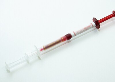 オフィスホワイトニング(全顎)