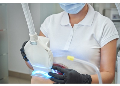 オフィスホワイトニング(片顎)