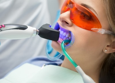 オフィスホワイトニング（上下）