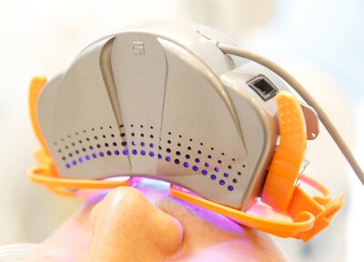 オフィスホワイトニング