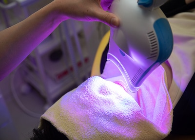 オフィスホワイトニング