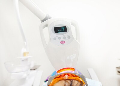 オフィスホワイトニング