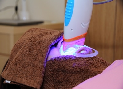 オフィスホワイトニング