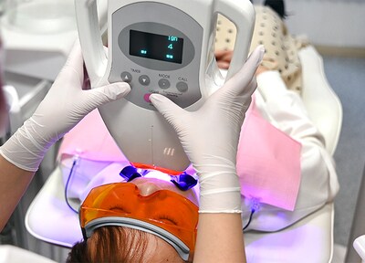 オフィスホワイトニング（4回プラン）