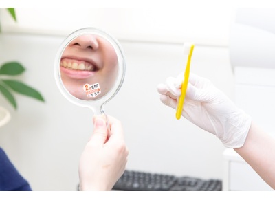 コスモス歯科クリニック ホワイトニング