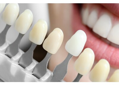 西の原歯科医院 ホワイトニング