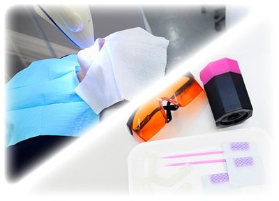 デュアルホワイトニング（両顎）