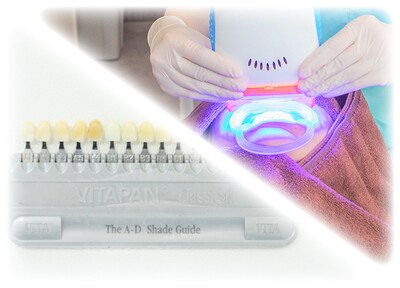 デュアルホワイトニング オフィスホワイトニング２回 ホームホワイトニングセット