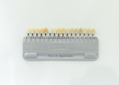 ホームホワイトニング