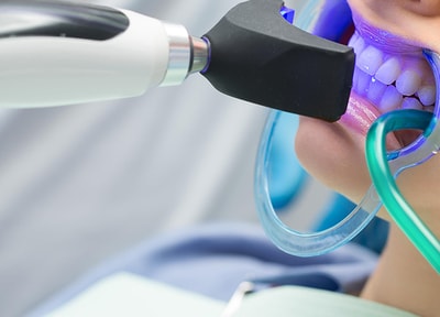 オフィスホワイトニング（上下）