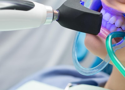 オフィスホワイトニング