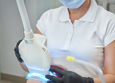 オフィスホワイトニング（片顎）