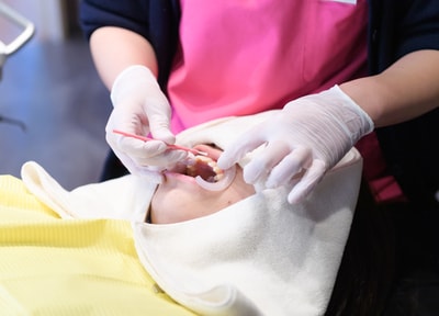 オフィスホワイトニング（全顎）