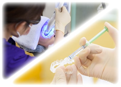 デュアルホワイトニング