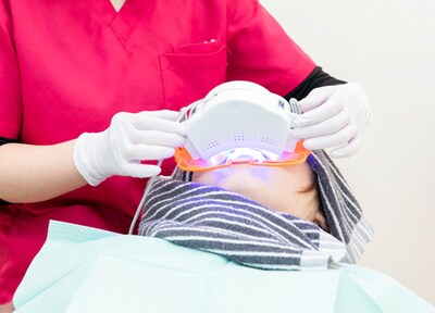 前処置・ホワイトニング（デュアルホワイトニング）