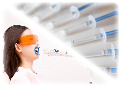 デュアルホワイトニング（上下）