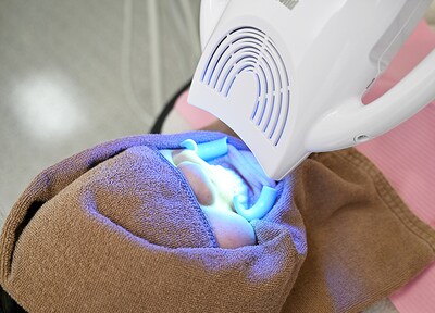 オフィスホワイトニング（施術1回コース）