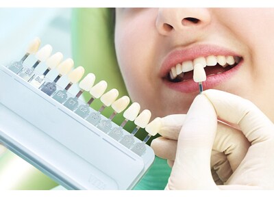 大阪T.T.C.梅田歯科医院 ホワイトニング