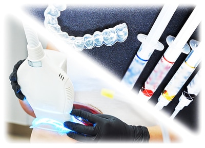 デュアルホワイトニング（全顎）