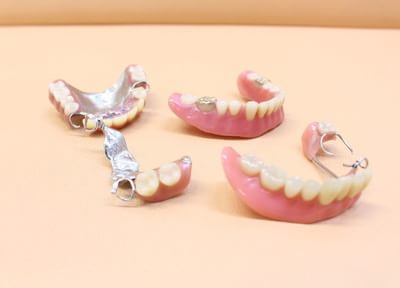 天然歯に近い歯を提供するためにも頼りがいのある歯科技工士との協力