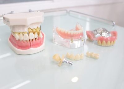 快適に使える入れ歯を提供するべく複数の素材を用意し、状態をしっかり踏まえたうえで処置をいたします
