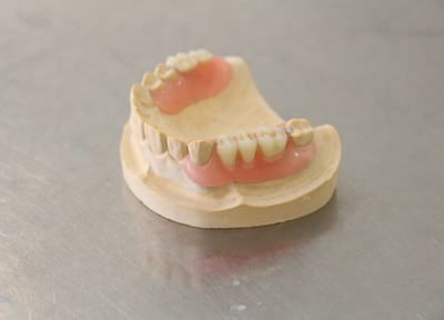 慣れるまで何度も調整をしていくことで、患者さまのお口にフィットする入れ歯を作成