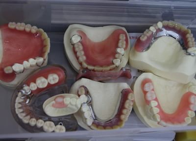 やまだ歯科クリニック（福岡市南区） 入れ歯・義歯
