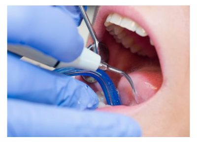 早期発見で歯をできる限り抜かない、削らない治療を目指しています
