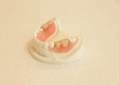 失った歯の原因を追及して、患者さまに合った入れ歯をご提供。