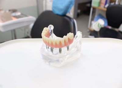 手術をした日に歯を入れることができる。入れ歯でお悩みの方はオールオンフォーがおすすめです