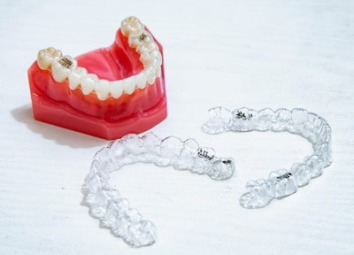 歯科ハミール　高田８８ マウスピース矯正