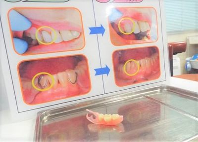 患者さまに適した入れ歯や義歯を提供できるよう心がけています