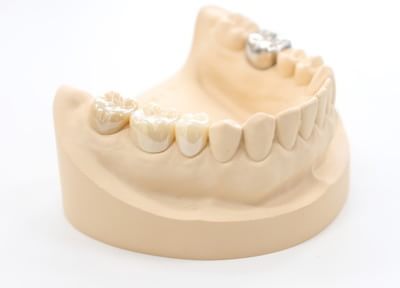 患者さまの負担を減らすためにさまざまな種類の入れ歯をご用意