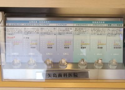 矢島歯科医院 つめ物・かぶせ物