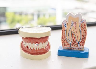 Q.歯を保護するためにどんな治療や対応を行っていますか？