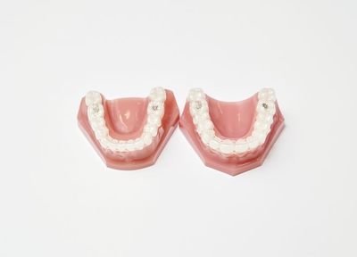 歯並びを整える以外にもメリットがある矯正治療