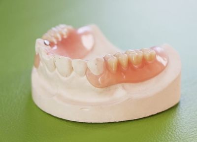 植木歯科医院 入れ歯・義歯