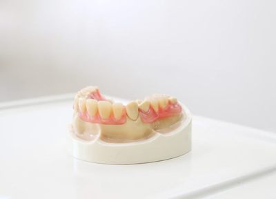 Q.総入れ歯を作るときに取り組んでいることはありますか？