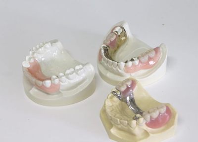 残った歯をいかに残せるかを考え、これ以上歯を失わないような入れ歯を提供しています