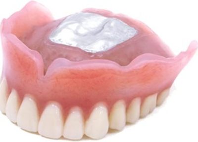 シリコーン製の入れ歯は外科処置が必要なく、失ってしまった歯の本数に合わせて対応できます