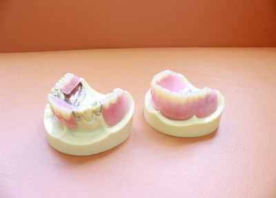 患者さまお一人おひとりのお口に合わせるため、設計図の段階からこだわった入れ歯をご用意いたします
