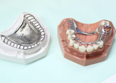 患者さまが納得できる状態まで調整して、長くお使いいただける入れ歯を作ります